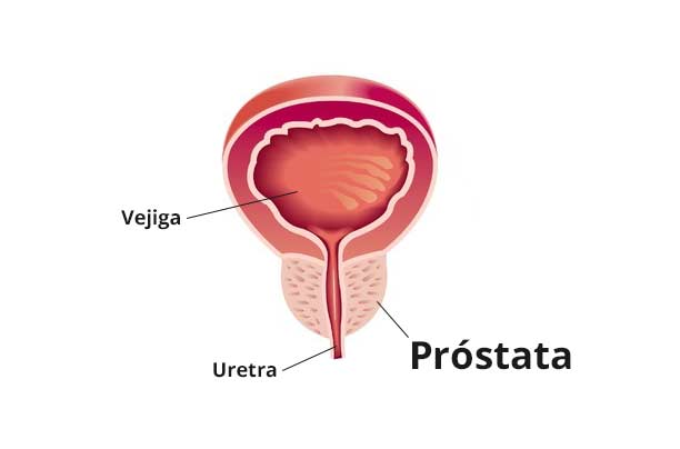 Was ist gut gegen prostata