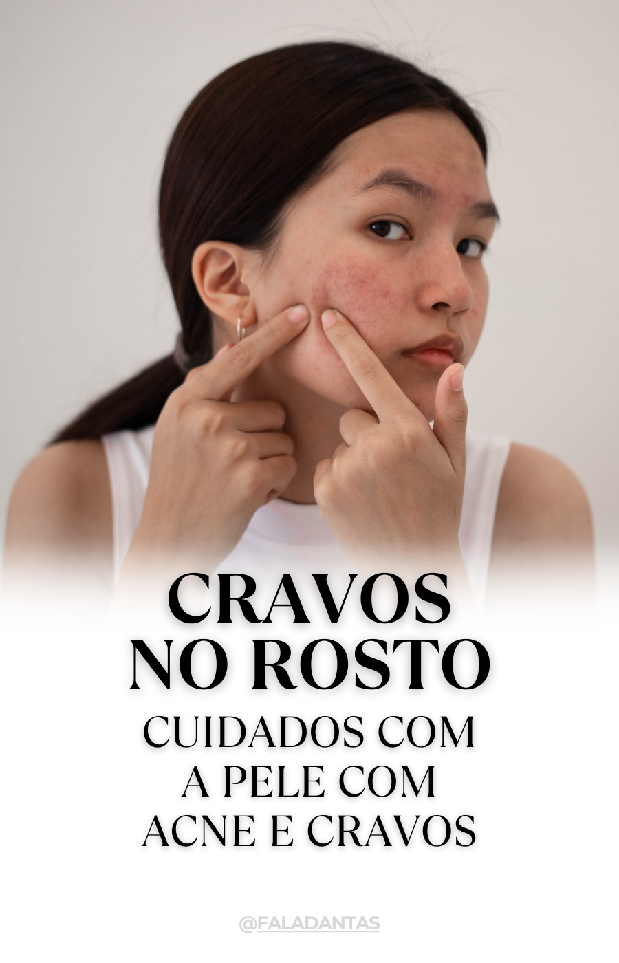 Elimine os cravos no rosto com essas dicas